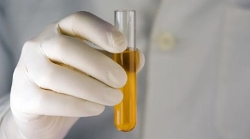 İdrarda Bol Bakteri Belirtileri ve Tedavisi